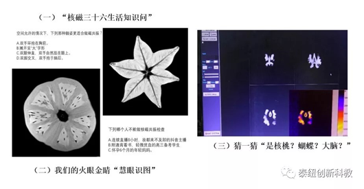 磁共振下呈现的图